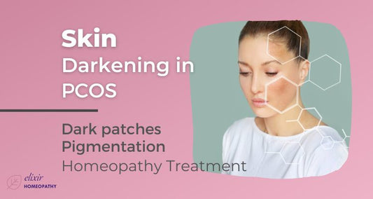 Skin darkening in PCOS - Treatment with homeopathy.